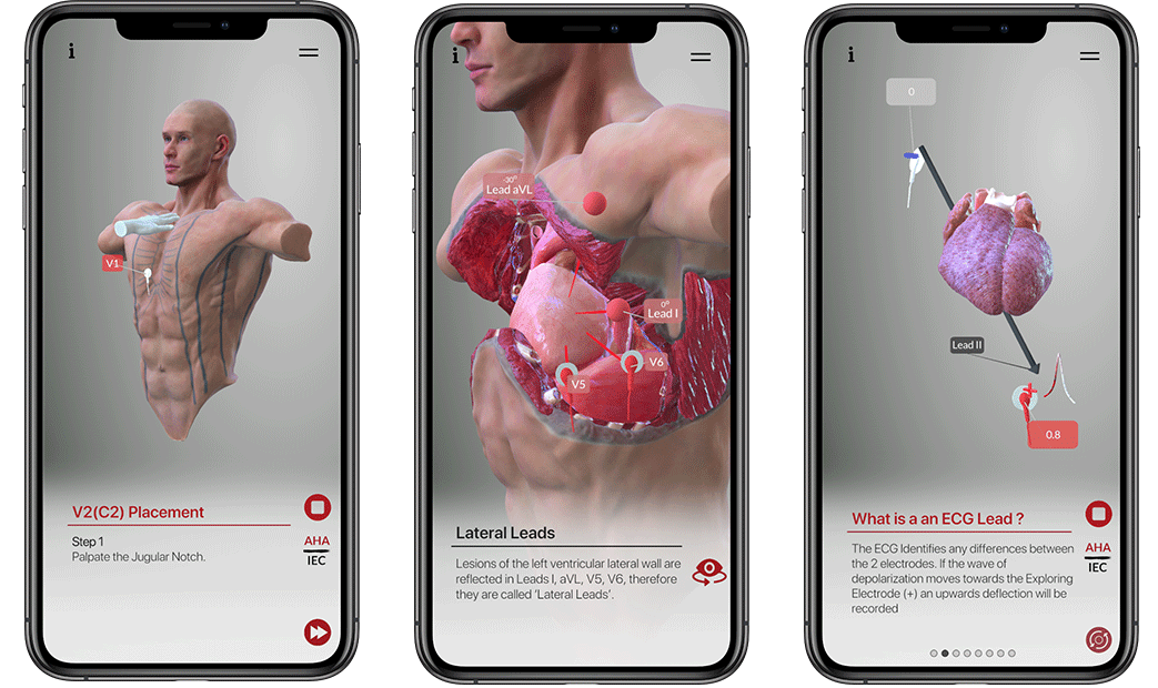 App ECGLeads