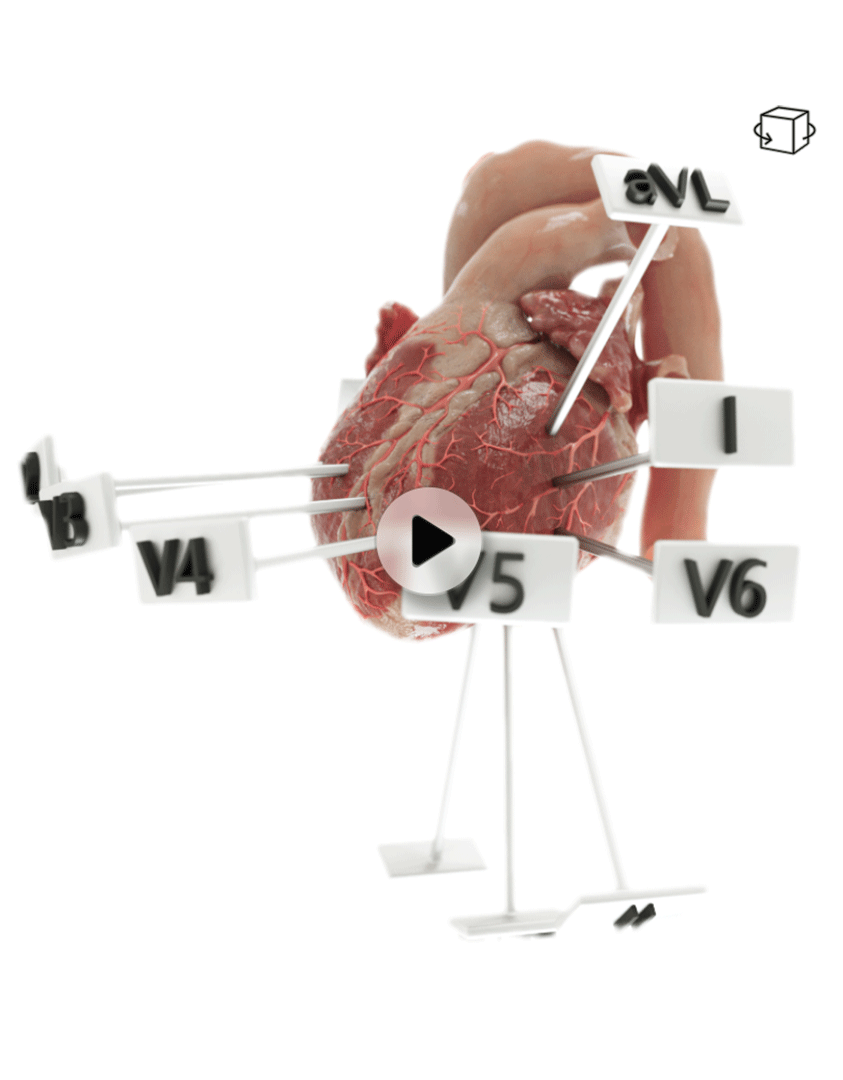 ECG leads and corresponding vessels